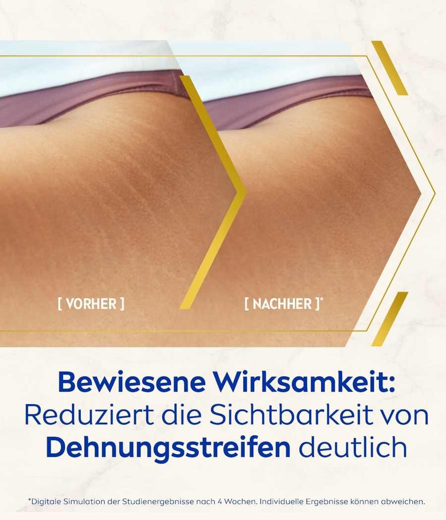 Vorher-Nachher-Vergleich von Dehnungsstreifen, Reduzierung sichtbar