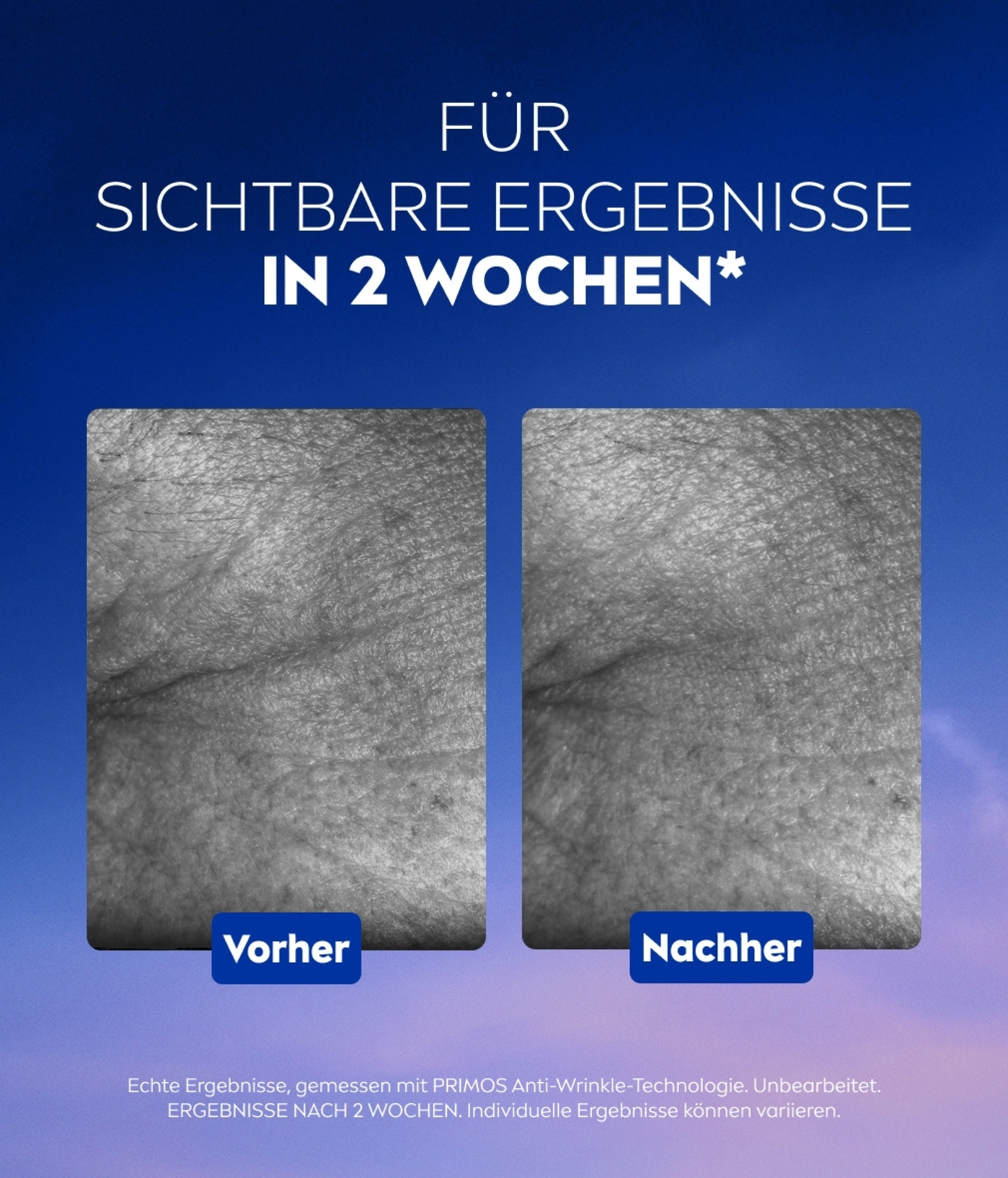 Vorher-Nachher-Vergleich, sichtbare Ergebnisse in 2 Wochen, Anti-Wrinkle-Technologie
