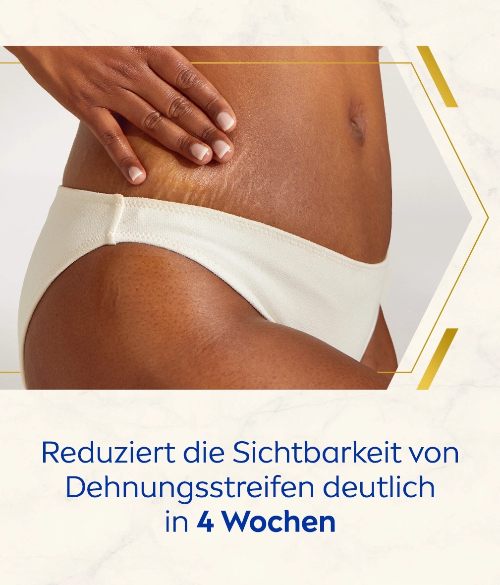 Bauch mit Dehnungsstreifen, Hand berührt Haut, Text: Reduziert Dehnungsstreifen in 4 Wochen