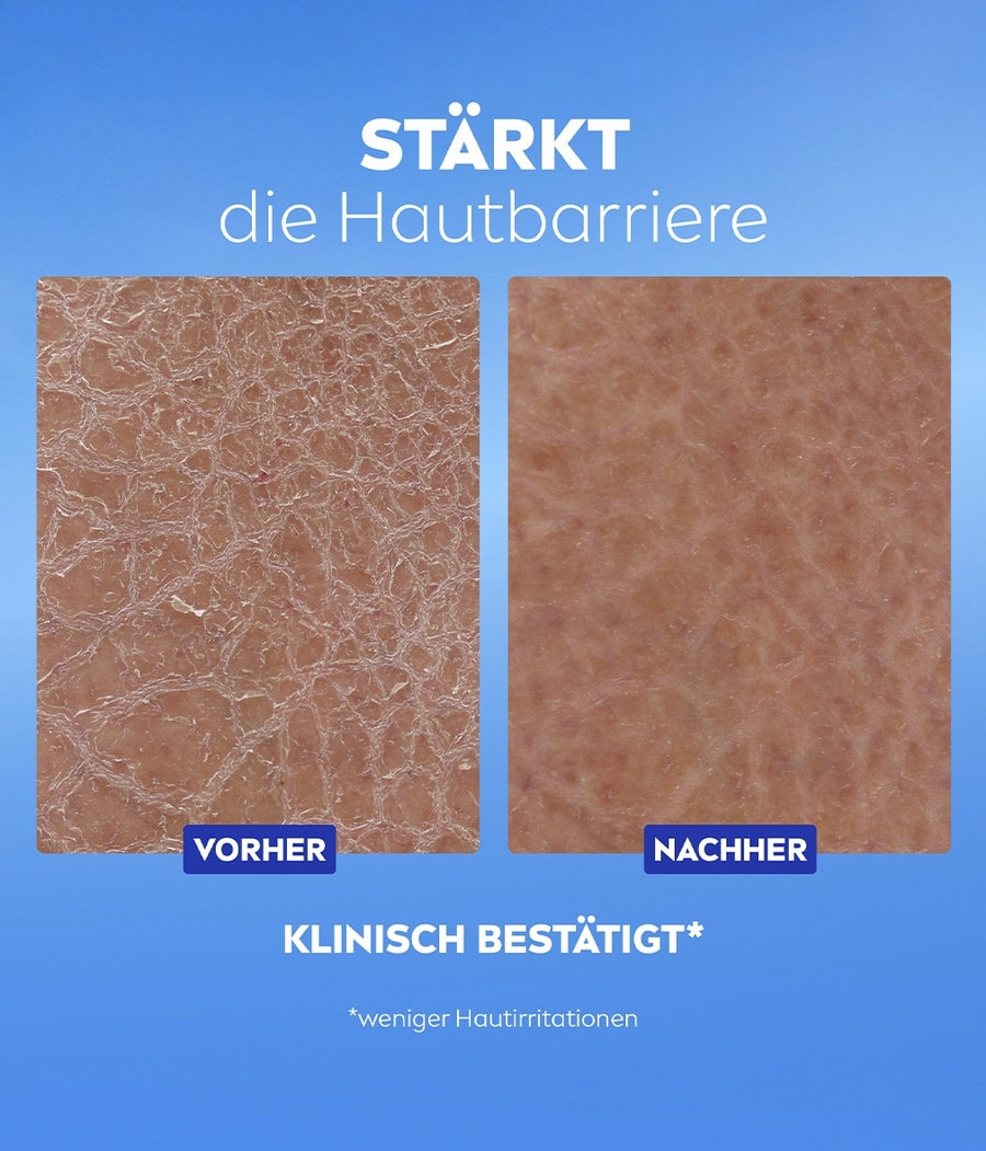 Vorher-Nachher-Vergleich der Hautbarriere, klinisch bestätigt