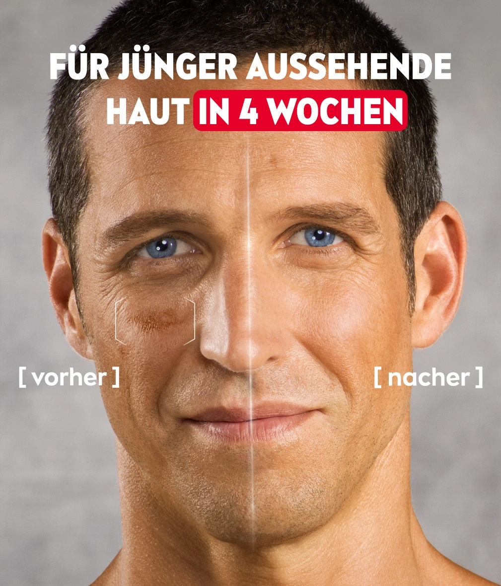 Vorher-Nachher-Vergleich: Hautverjüngung in 4 Wochen. Mann mit jünger aussehender Haut.