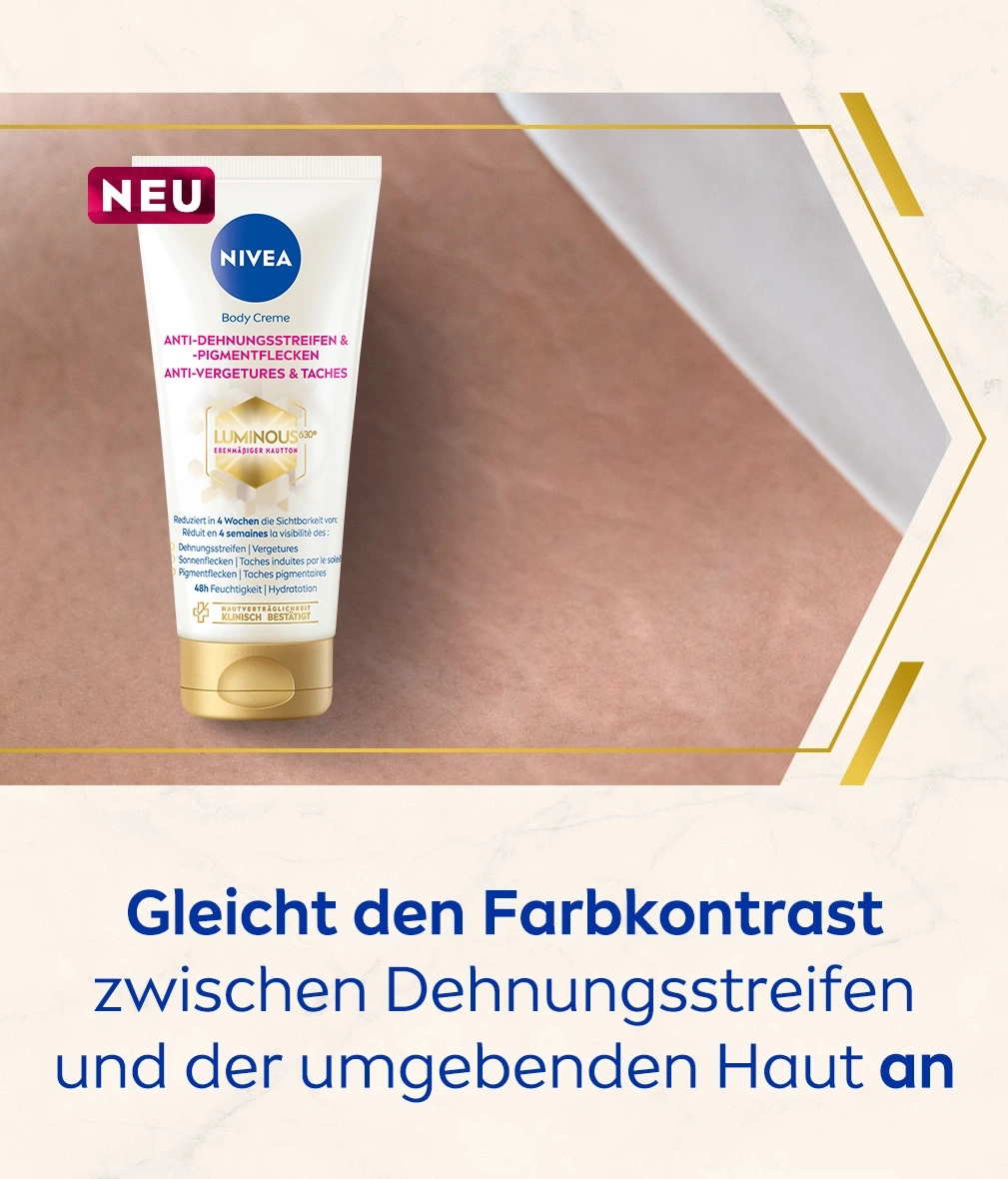 Nivea Body Creme, reduziert Dehnungsstreifen und Pigmentflecken, Hautpflege