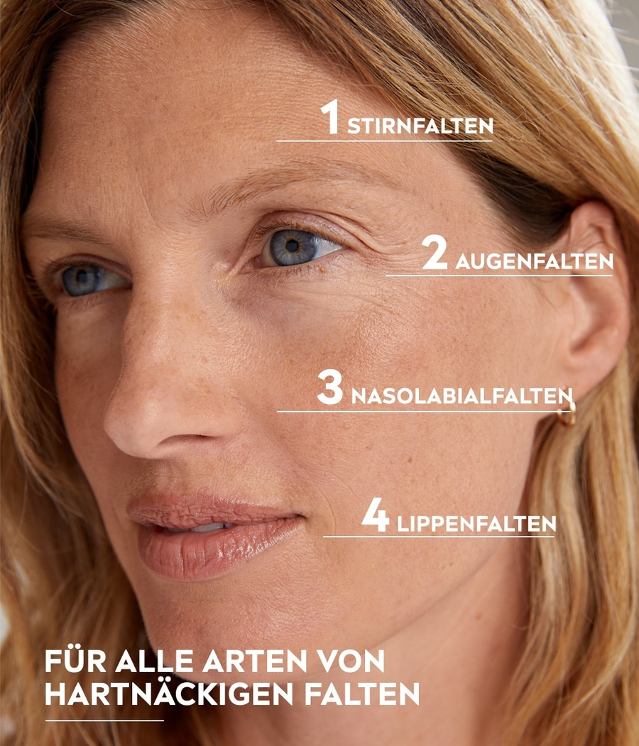 Frau mit Falten, die durch Zahlen markiert sind, um verschiedene Bereiche zu identifizieren.