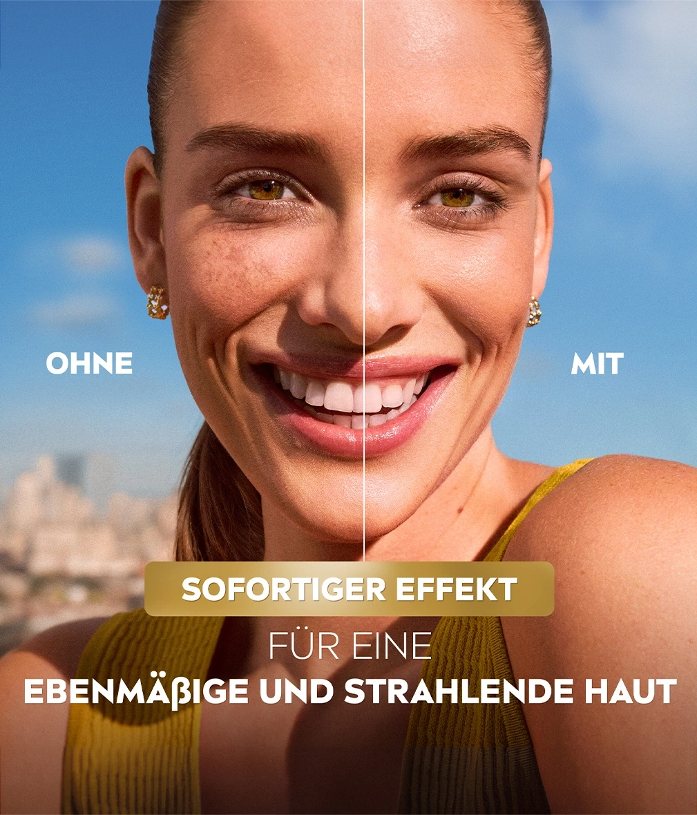 Vorher-Nachher-Vergleich: Hautunreinheiten werden durch das Produkt reduziert, für einen ebenmäßigen Teint.