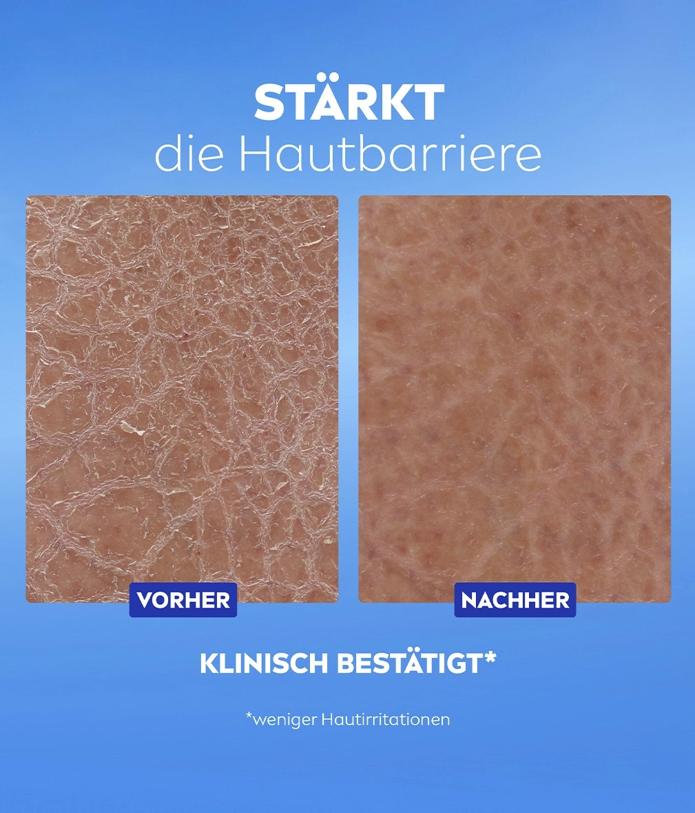 Vorher-Nachher-Vergleich der Hautbarriere, klinisch bestätigt
