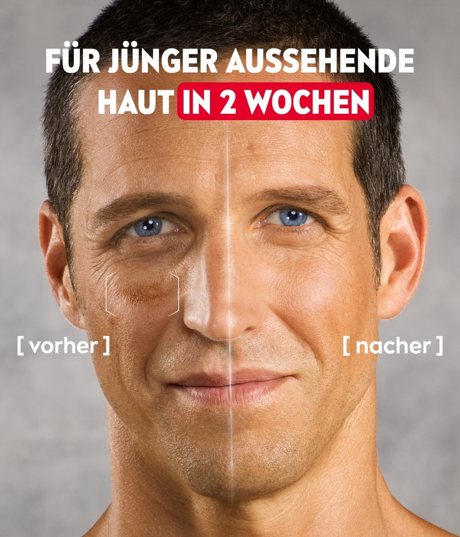 Vorher-Nachher-Vergleich: Hautverjüngung in 2 Wochen. Mann mit jünger aussehender Haut.