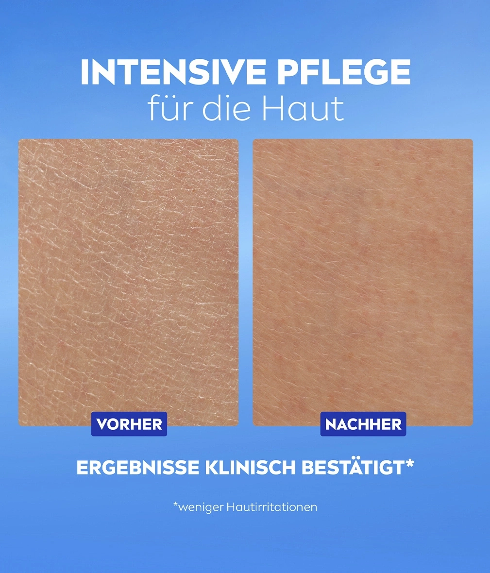 Zwei Hautbilder: vorher trockene Haut, nachher gepflegte Haut.