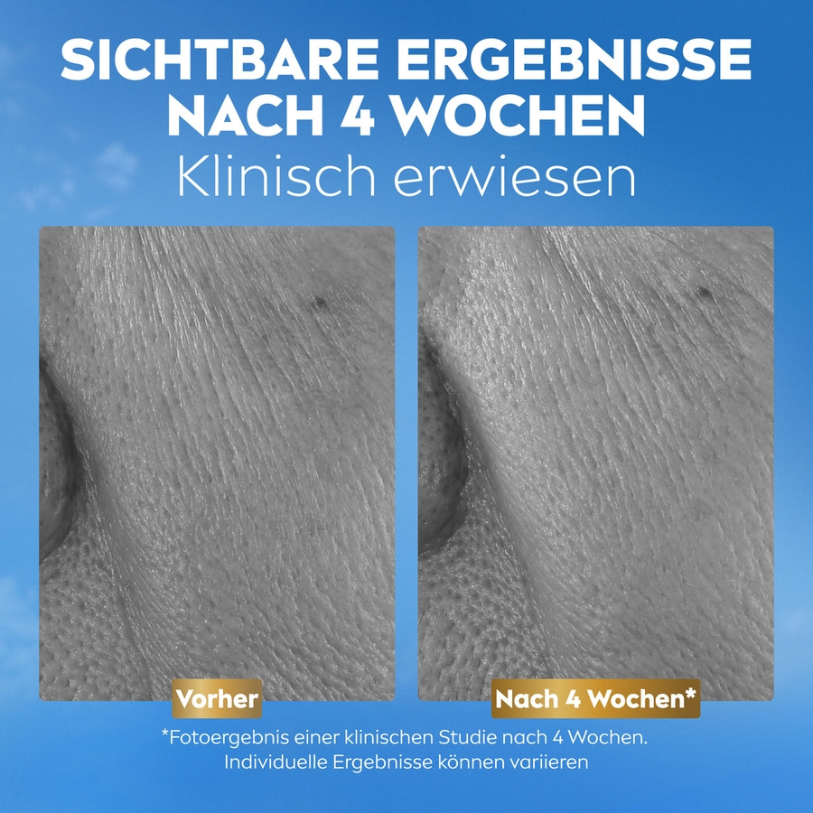 Vorher-Nachher-Vergleich von Hautfalten nach vier Wochen klinisch erwiesen
