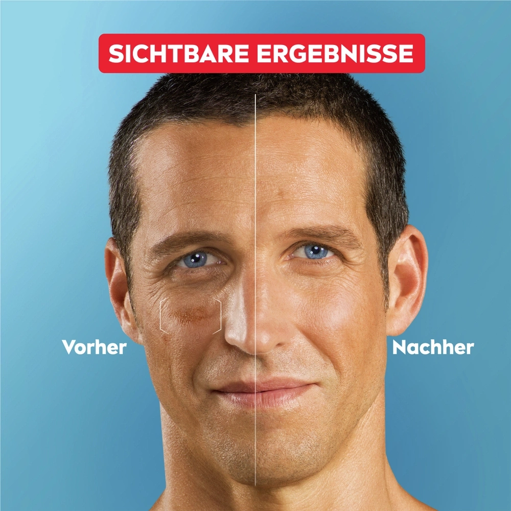 Vorher-Nachher-Vergleich eines Mannes mit Hautpigmentierung