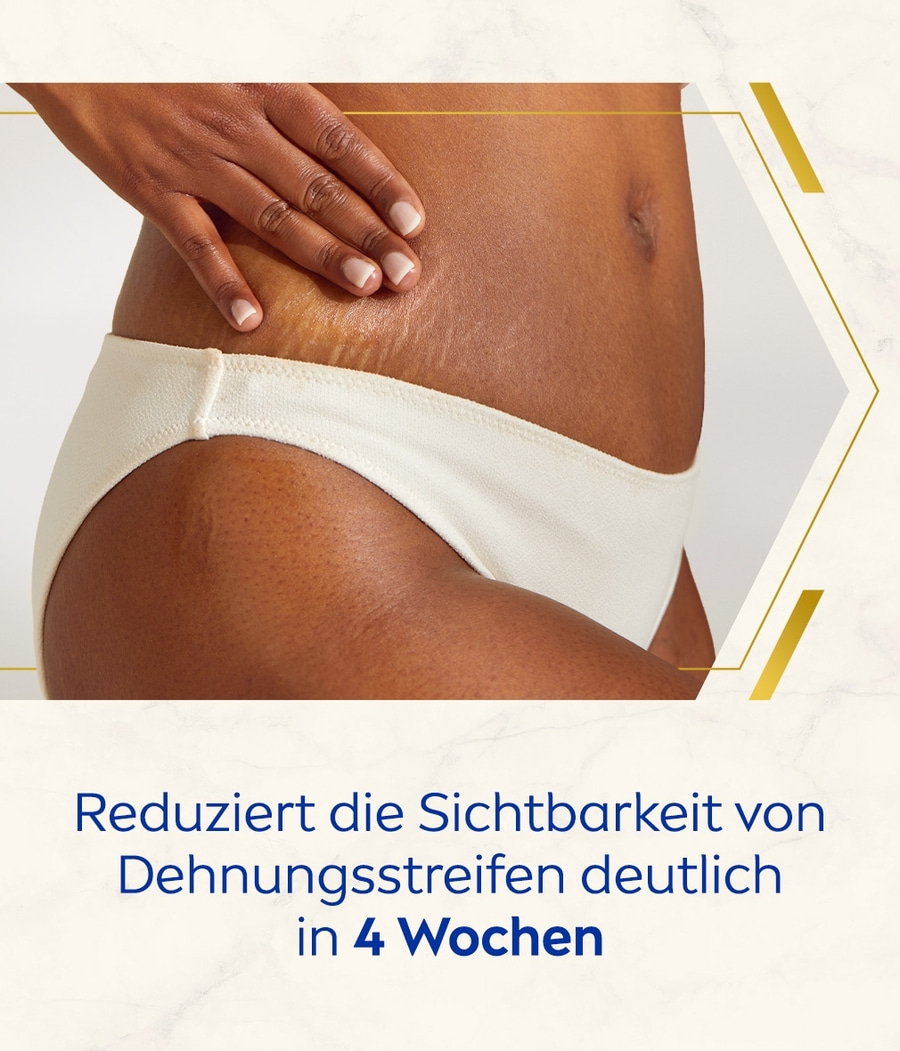 NIVEA Anti-Dehnungsstreifen + Pigmentflecken LUMINOUS630® Body Lotion 2 x 200ml